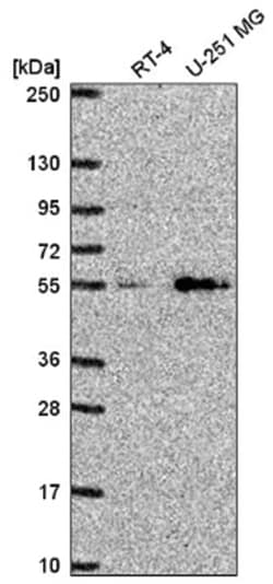 SLC29A4 Antibody, Novus Biologicals 100&mu;L; Unlabeled:Antibodies, Polyclonal