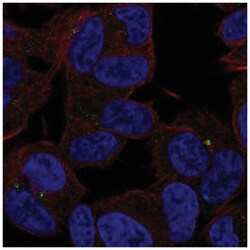 SLC35D3 Antibody, Novus Biologicals 25 &mu;L, Unlabeled:Antibodies, Polyclonal