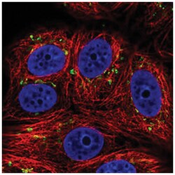 SLC35E1 Antibody, Novus Biologicals 100&mu;L; Unlabeled:Antibodies, Polyclonal