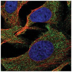 SLC35G2 Antibody, Novus Biologicals 100&mu;L; Unlabeled:Antibodies, Polyclonal