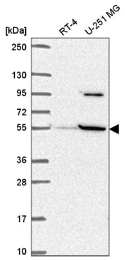 SLC37A3 Antibody, Novus Biologicals 100&mu;L; Unlabeled:Antibodies, Polyclonal