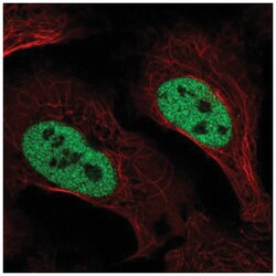 SLC4A3 Antibody, Novus Biologicals 100 &mu;L | Buy Online | Novus Biologicals | Fisher Scientific