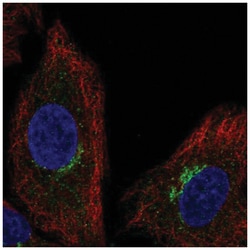 SLC6A16 Antibody, Novus Biologicals 25 &mu;L, Unlabeled:Antibodies, Polyclonal