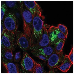 SLC6A4/5-HTTLPR/Serotonin transporter Antibody, Novus Biologicals 100&mu;L;