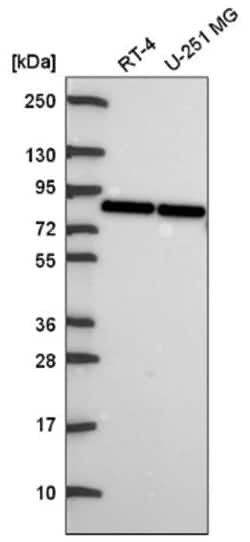 SLCO1A2 Antibody, Novus Biologicals:Antibodies:Primary Antibodies