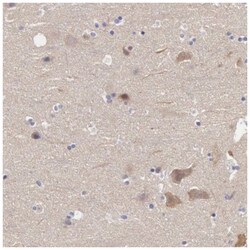 SLITRK4 Antibody, Novus Biologicals 100&mu;L; Unlabeled:Antibodies, Polyclonal