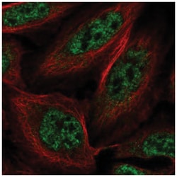 SLU7 Antibody, Novus Biologicals 100&mu;L; Unlabeled:Antibodies, Polyclonal
