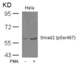 Smad2, p Ser467 Antibody - BSA Free, Novus Biologicals 0.025 mg:Antibodies,