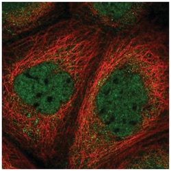 Smad3 Antibody, Novus Biologicals 100&mu;L; Unlabeled:Antibodies, Polyclonal
