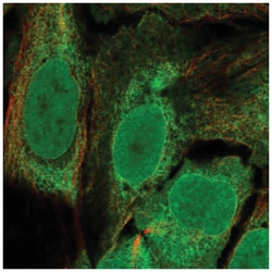 SMAP Antibody, Novus Biologicals 100&mu;L; Unlabeled:Antibodies, Polyclonal