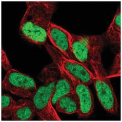 SMARCA1 Antibody, Novus Biologicals:Antibodies:Primary Antibodies