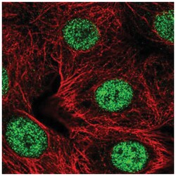SMARCD2 Antibody, Novus Biologicals 100&mu;L; Unlabeled:Antibodies, Polyclonal