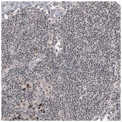 SMCHD1 Antibody (CL4270), Novus Biologicals 25 &mu;L; Unlabeled:Antibodies,