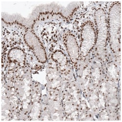 SMCHD1 Antibody (CL4265), Novus Biologicals 100&mu;L; Unlabeled:Antibodies,