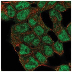 SMCX Antibody, Novus Biologicals 100&mu;L; Unlabeled:Antibodies, Polyclonal