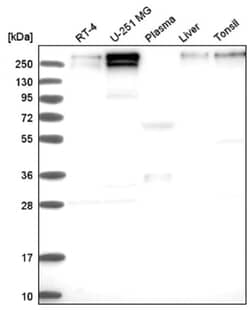 SMCX Antibody, Novus Biologicals 25 &mu;L:Antibodies, Polyclonal