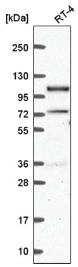 Smek1 Antibody, Novus Biologicals 25 &mu;L, Unlabeled:Antibodies, Polyclonal
