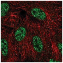 SMG1 Antibody, Novus Biologicals 25 &mu;L:Antibodies, Polyclonal