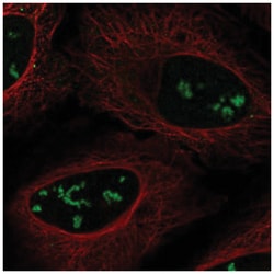 SMKR1 Antibody, Novus Biologicals:Antibodies:Primary Antibodies