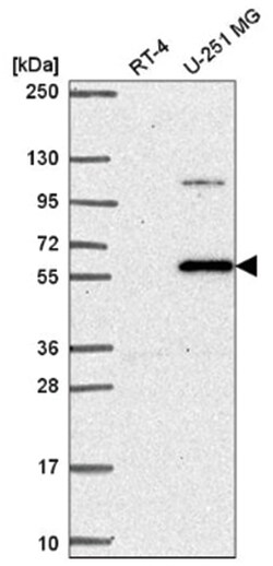SMOX Antibody, Novus Biologicals 25 &mu;L; Unconjugated:Antibodies, Polyclonal