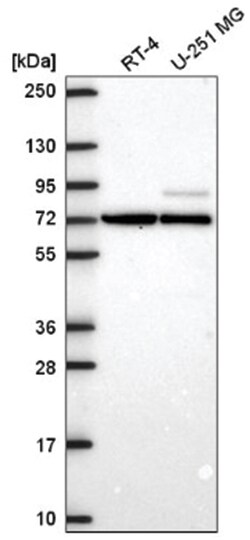 SMURF2 Antibody, Novus Biologicals 100&mu;L; Unlabeled:Antibodies, Polyclonal