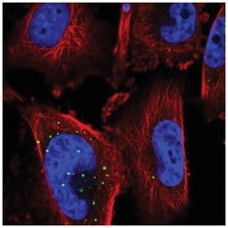SMYD3 Antibody, Novus Biologicals 100&mu;L; Unlabeled:Antibodies, Polyclonal