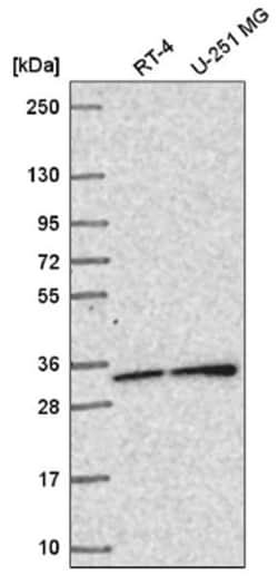 SNAP29 Antibody, Novus Biologicals 100&mu;L; Unlabeled:Antibodies, Polyclonal