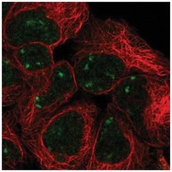 SNAP45 Antibody, Novus Biologicals 100&mu;L; Unlabeled:Antibodies, Polyclonal