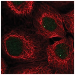SNAPC3 Antibody, Novus Biologicals 100&mu;L; Unlabeled:Antibodies, Polyclonal