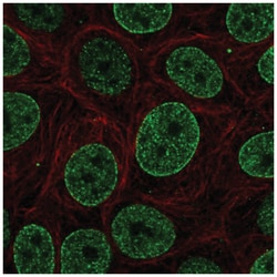 SNAPC4 Antibody, Novus Biologicals 25 &mu;L, Unlabeled:Antibodies, Polyclonal