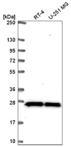 SNRPB Antibody, Novus Biologicals 25 &mu;L, Unlabeled:Antibodies, Polyclonal