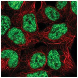SNRPB2 Antibody, Novus Biologicals 25 &mu;L, Unlabeled:Antibodies, Polyclonal