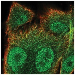 SNX10 Antibody, Novus Biologicals 25 &mu;L, Unlabeled:Antibodies, Polyclonal