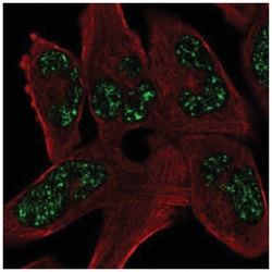 SOHLH1 Antibody, Novus Biologicals 100&mu;L; Unlabeled:Antibodies, Polyclonal