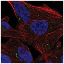Soluble Liver/Pancreas Antigen Antibody, Novus Biologicals 100 &mu;L | Buy Online | Novus Biologicals | Fisher Scientific