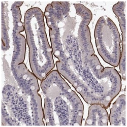 Solute carrier family 22 member 18 Antibody, Novus Biologicals:Antibodies:Primary