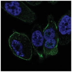 Somatostatin R5/SSTR5 Antibody, Novus Biologicals 25 &mu;L, Unlabeled:Antibodies,
