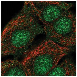 SorCS2 Antibody, Novus Biologicals 100&mu;L; Unlabeled:Antibodies, Polyclonal