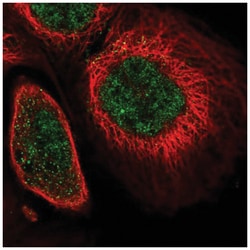 SOX13 Antibody, Novus Biologicals 100&mu;L; Unlabeled:Antibodies, Polyclonal