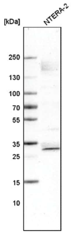 SOX21 Antibody (CL4681), Novus Biologicals 25 &mu;L; Unlabeled:Antibodies,