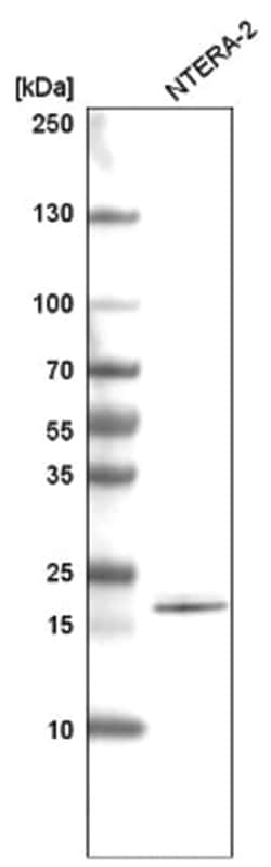 SOX21 Antibody (CL4688), Novus Biologicals 100&mu;L; Unlabeled:Antibodies,