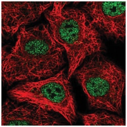 SOX22 Antibody, Novus Biologicals 100&mu;L; Unlabeled:Antibodies, Polyclonal