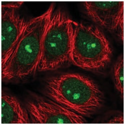 SPATA2 Antibody, Novus Biologicals 100&mu;L; Unlabeled:Antibodies, Polyclonal