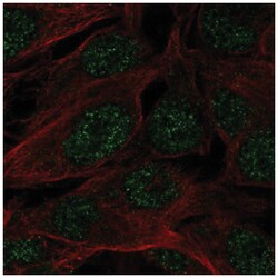 SPATS1 Antibody, Novus Biologicals 100 &mu;L | Buy Online | Novus Biologicals | Fisher Scientific