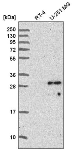 Sperm-associated antigen 7 Antibody, Novus Biologicals:Antibodies:Primary