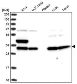 SPG21 Antibody, Novus Biologicals 100 &mu;L | Buy Online | Novus Biologicals | Fisher Scientific