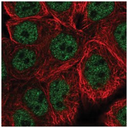 SPG8 Antibody, Novus Biologicals 25 &mu;L, Unlabeled:Antibodies, Polyclonal