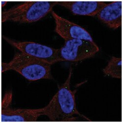 Sphingosine Kinase 2/SPHK2 Antibody, Novus Biologicals:Antibodies:Primary
