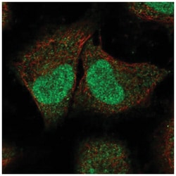 SPIN2A Antibody, Novus Biologicals 25 &mu;L:Antibodies, Polyclonal
