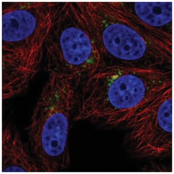 SPPL2a Antibody, Novus Biologicals 25 &mu;L, Unlabeled:Antibodies, Polyclonal